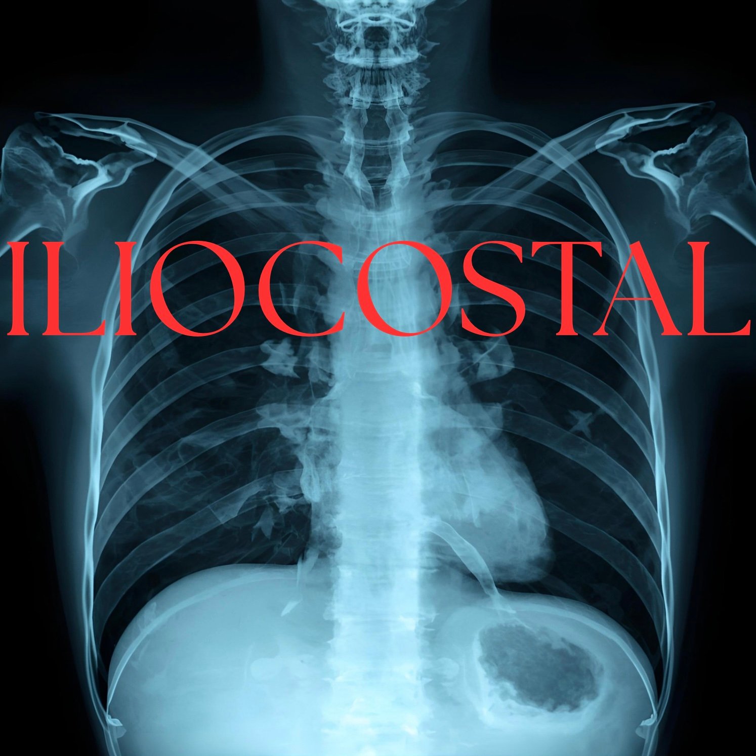Iliocostal